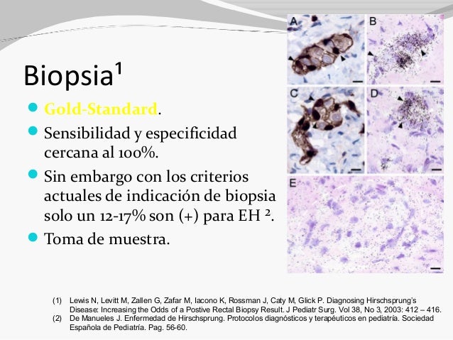 enfermedad de hirschsprung diagnostico